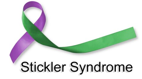 Détachement de la rétine : un défi persistant pour le syndrome de Stickler !