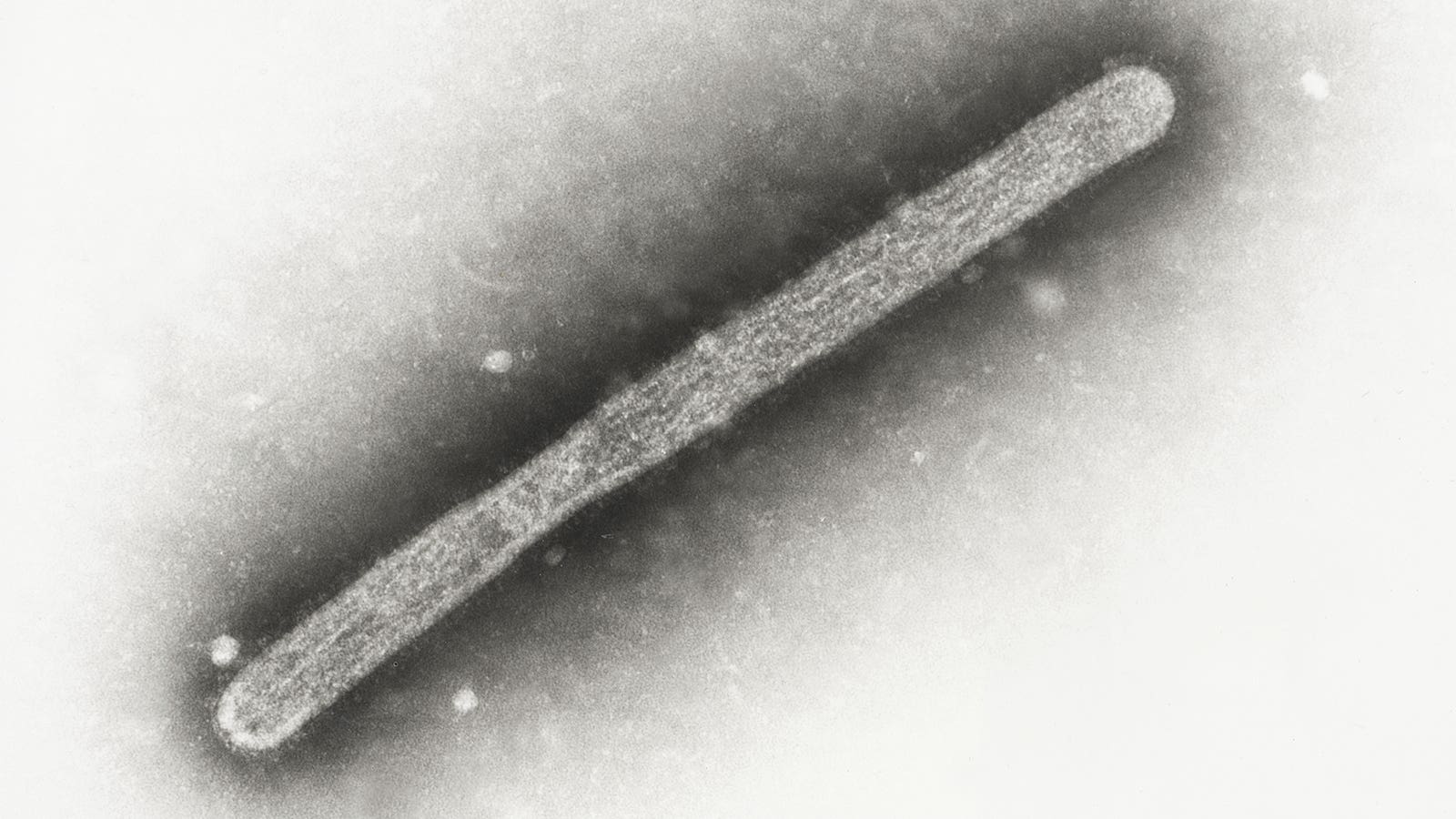 Aucune Infection Asymptomatique de Grippe Aviaire chez les Travailleurs des Fermes Laitières : Une Petite Étude Révèle des Résultats Encouragements !