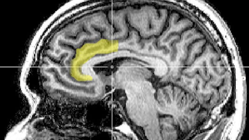 Comment les placebos trompent le cerveau pour apaiser la douleur : un phénomène fascinant !