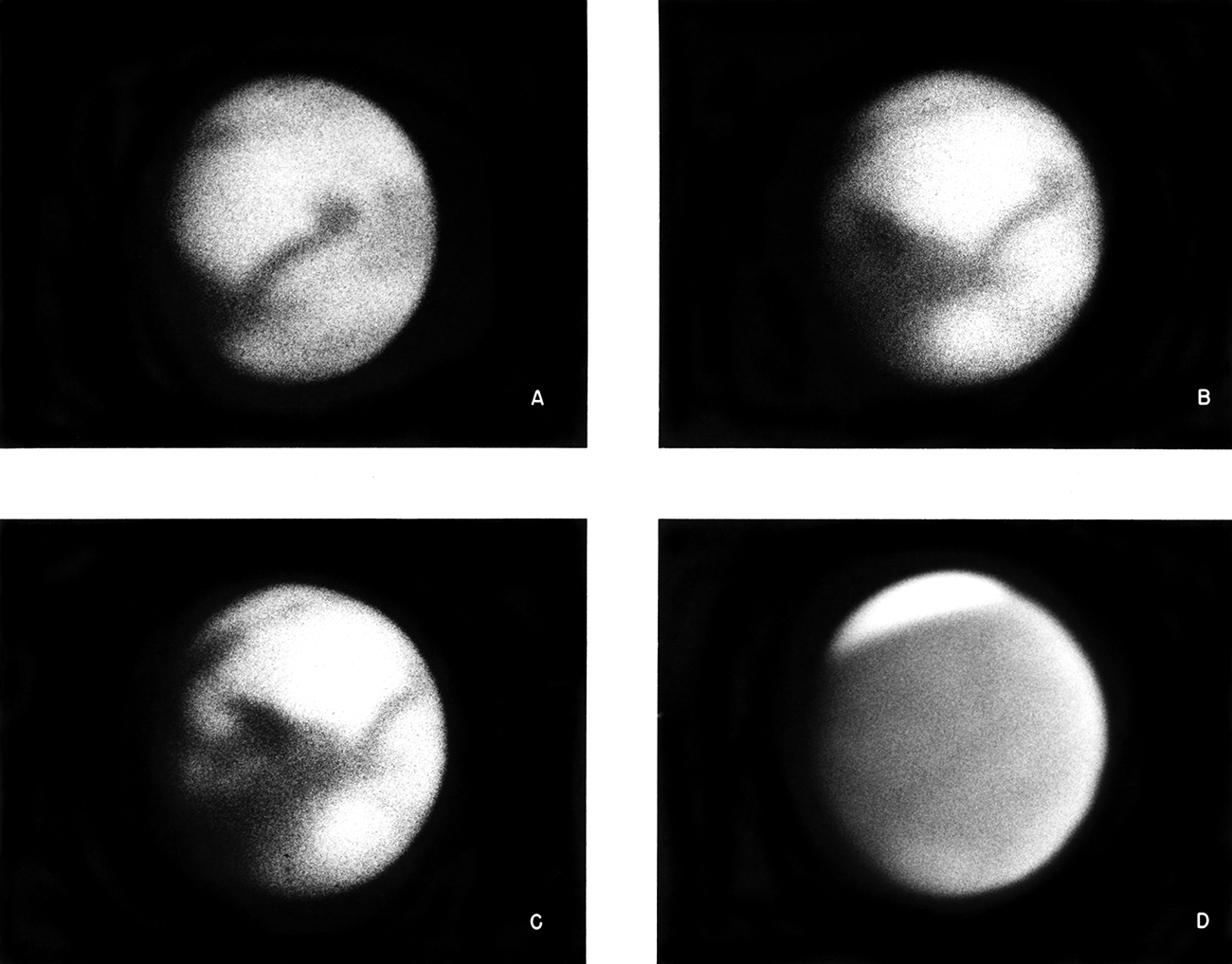 Images de Mars prises par le télescope Hooker