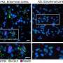 Une étude révèle les facteurs de vulnérabilité et de résilience face à Alzheimer dans différentes régions du cerveau