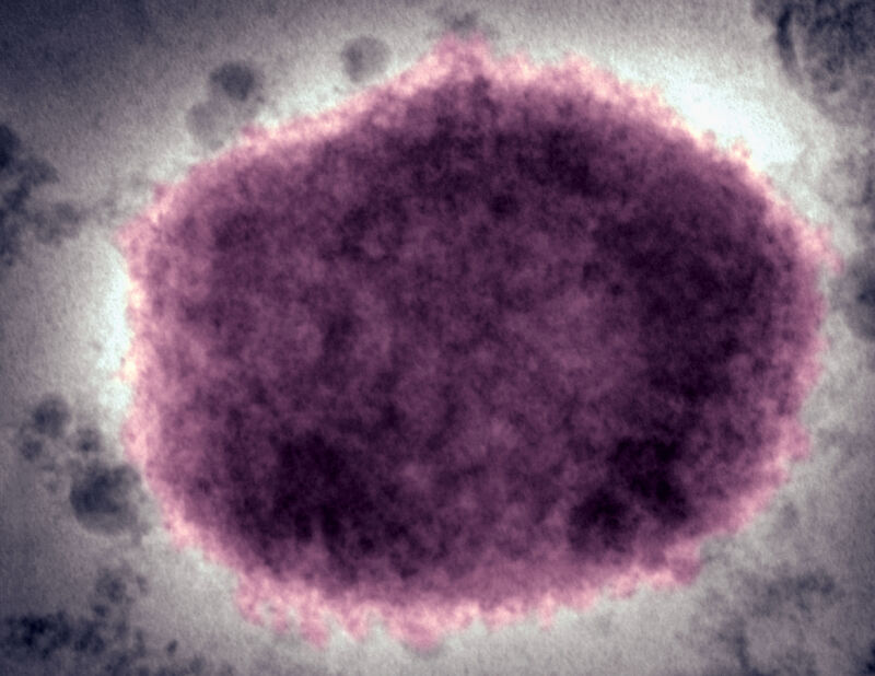 technologie Une micrographie électronique à contraste négatif d'un virion du virus <a href=