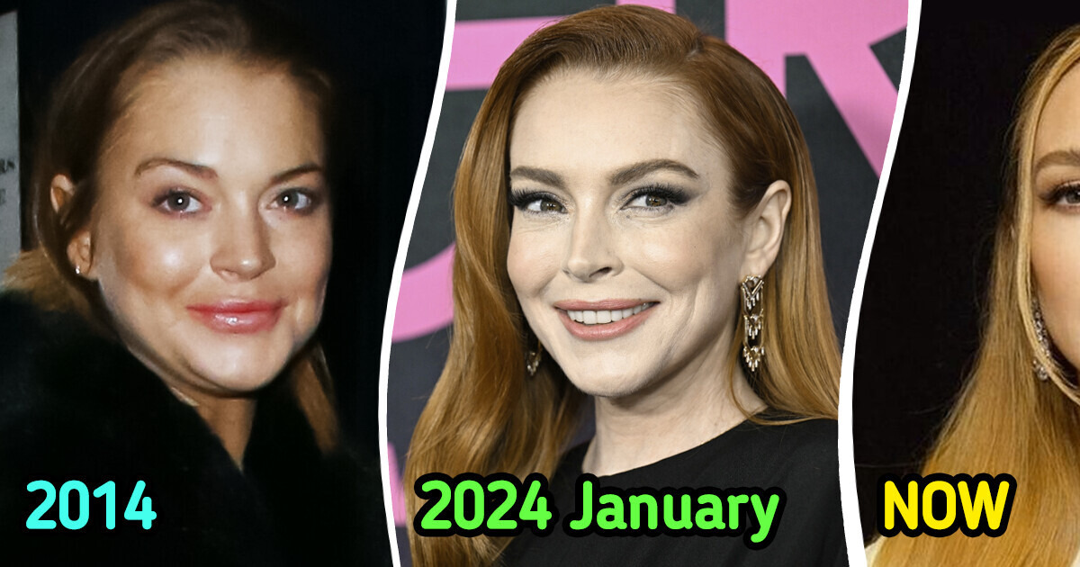 “She Got Every Drop of That Filler Dissolved,” Lindsay Lohan’s Latest Appearance Creates Stir