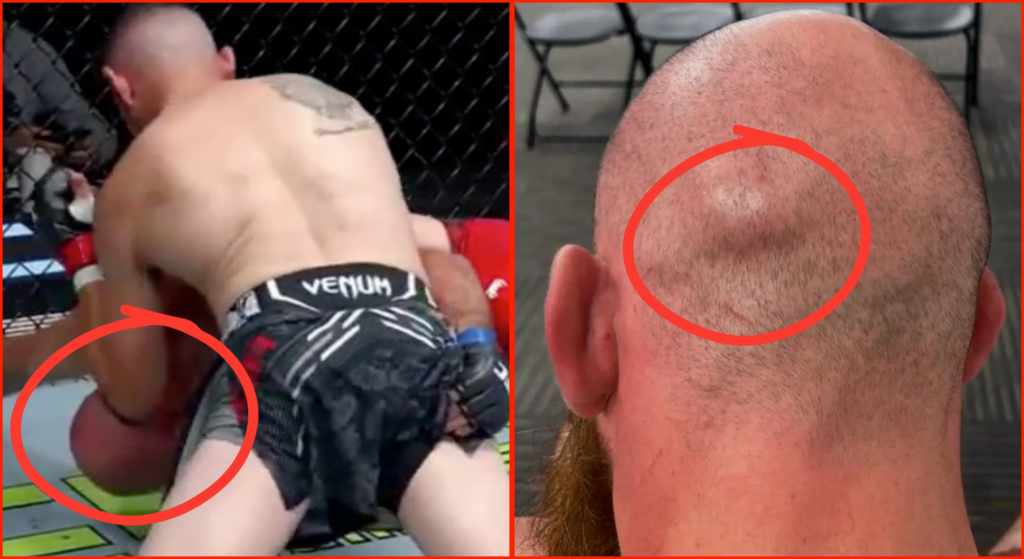 ‘This should be a no contest’… UFC fighter’s wife calls for first round KO loss to be overturned after ‘illegal elbow’