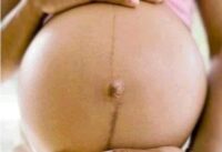 Reason Why Black Line Appear Along The Stomach Of Pregnant Women And It Functions