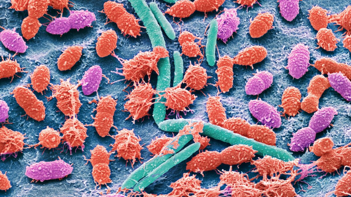 Scientists invent tool to see how ‘healthy’ your gut microbiome is — does it work?