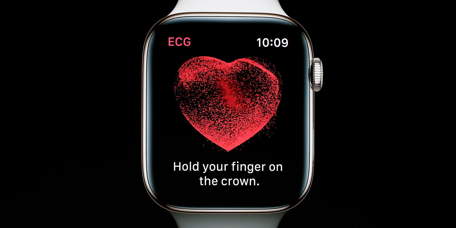 technologie Apple Watch ECG électrocardiogramme